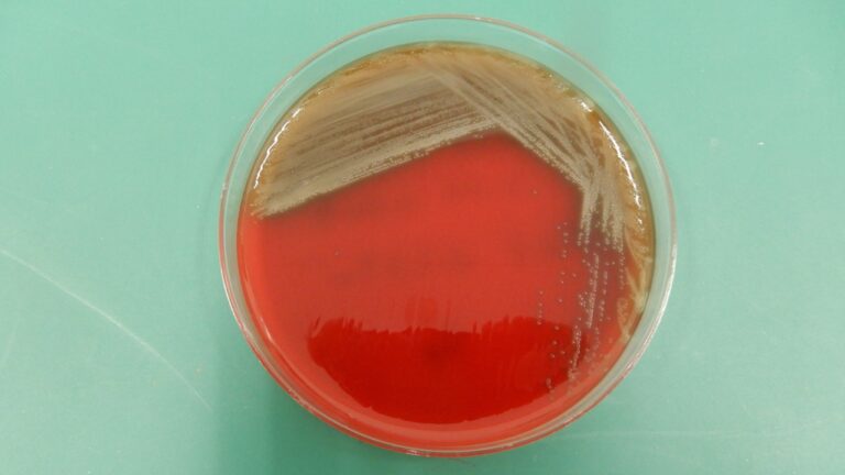 ペニシリン耐性肺炎球菌性髄膜炎は最小阻止濃度を確認する. ペニシリンG(PCG)のMIC > 0.125 μg/mL (0.12) 以上は ...